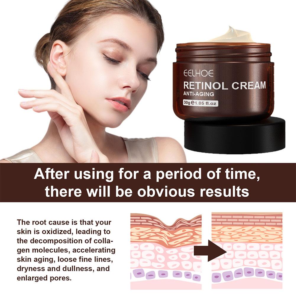 EELHOE 1/2/3/5PCS (ซื้อ 3 แถม  - Skincare Retinol บทวิจารณ์และราคา