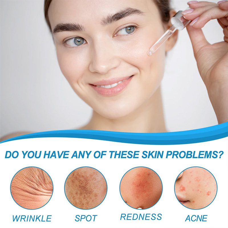 1/3/5pcs B5 รูขุมขนเซรั่มกรดไฮ - Skincare La Roche Posay บทวิจารณ์และราคา