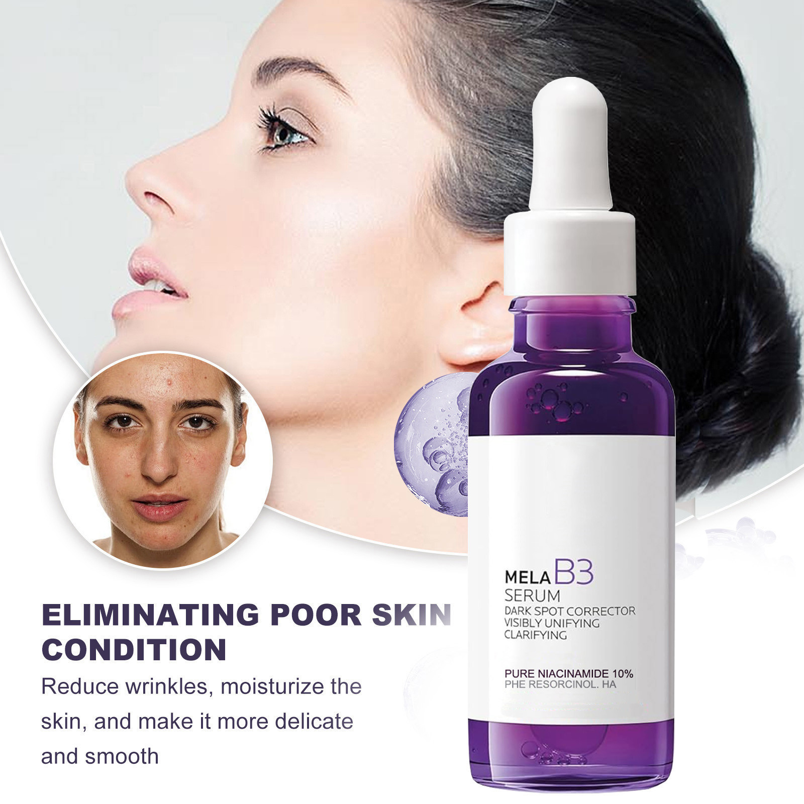 เซรั่มบำรุงผิวหน้า 5in1 ไนอะซิ - Skincare La Roche Posay บทวิจารณ์และราคา