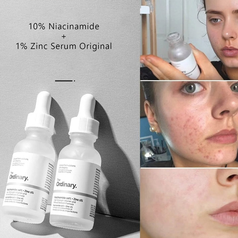 เซรั่ม The Ordinary Niacinamid - Skincare La Roche Posay บทวิจารณ์และราคา