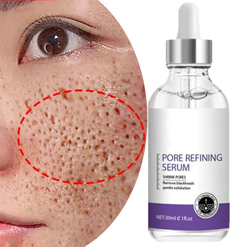 ผิว | การปรับรูขุมขนใหม่เซรั่ม - Skincare La Roche Posay บทวิจารณ์และราคา