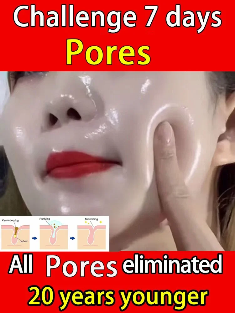 ผิว | การปรับรูขุมขนใหม่เซรั่ม - Skincare La Roche Posay บทวิจารณ์และราคา