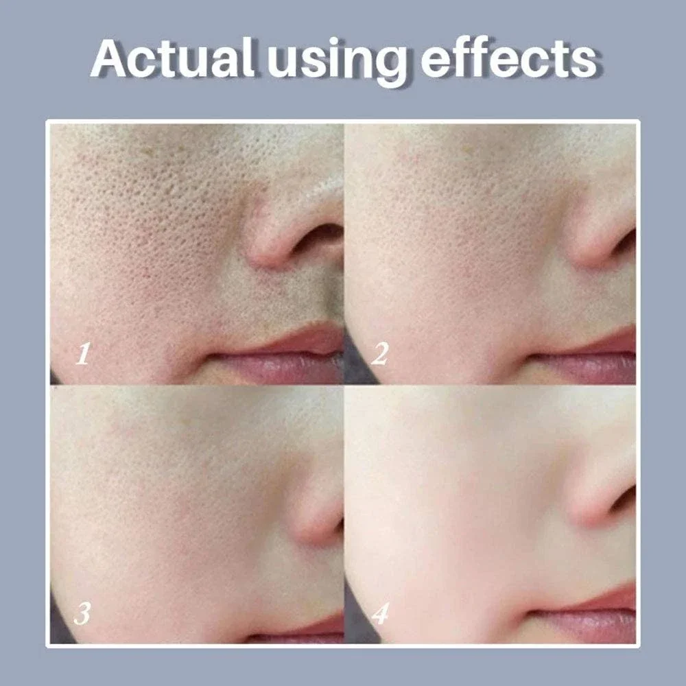 ผิว | การปรับรูขุมขนใหม่เซรั่ม - Skincare La Roche Posay บทวิจารณ์และราคา